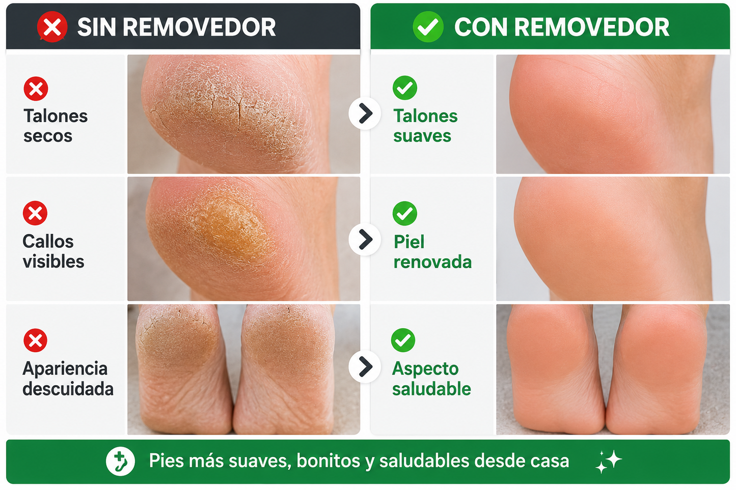 REMOVEDOR ELÉCTRICO DE CALLOS PARA PIES